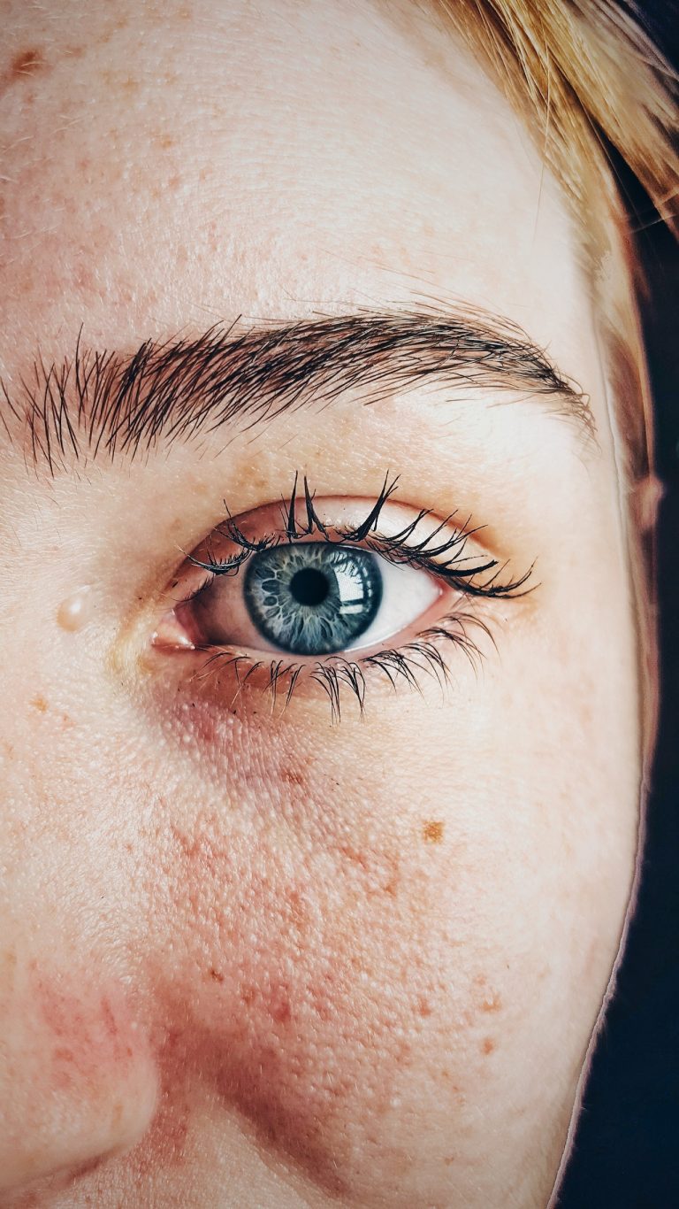 Wie pflegt man die Haut um die Augen?